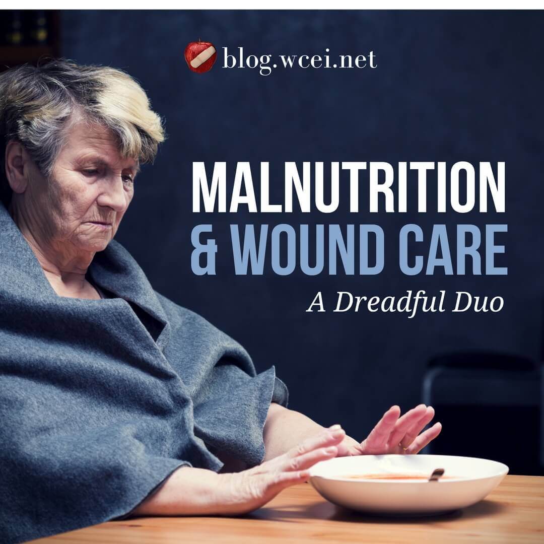 Malnutrition and Wound Care: A Dreadful Duo - Check out these top tips to recognize, treat and prevent malnutrition – and get those patient wounds healing.