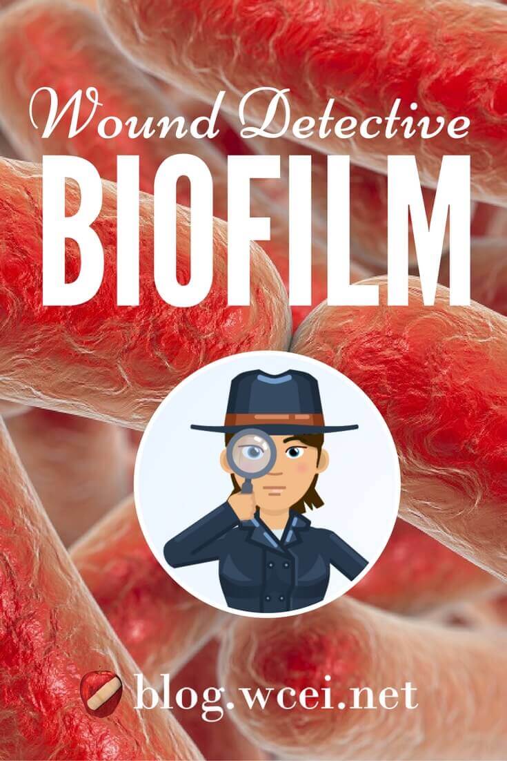 How to Get Away with Killing Biofilm: Even the best wound care detectives are challenged by this sneaky culprit that delays healing. Here’s how to identify biofilm bacteria and solve the case.