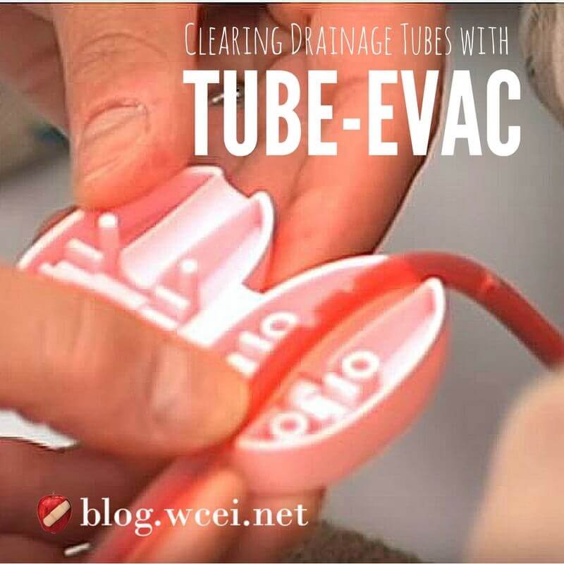 Cancer Patient's Husband Invents Device to Help Others - Clearing drainage tubes has gotten easier, thanks to a breast cancer patient's husband and his invention, Tube-Evac.