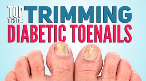 Can You Cut A Diabetics Toenails