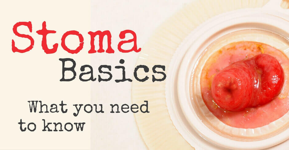 Stomas: What You Need to Know - WCEI - Blog WCEI – Blog