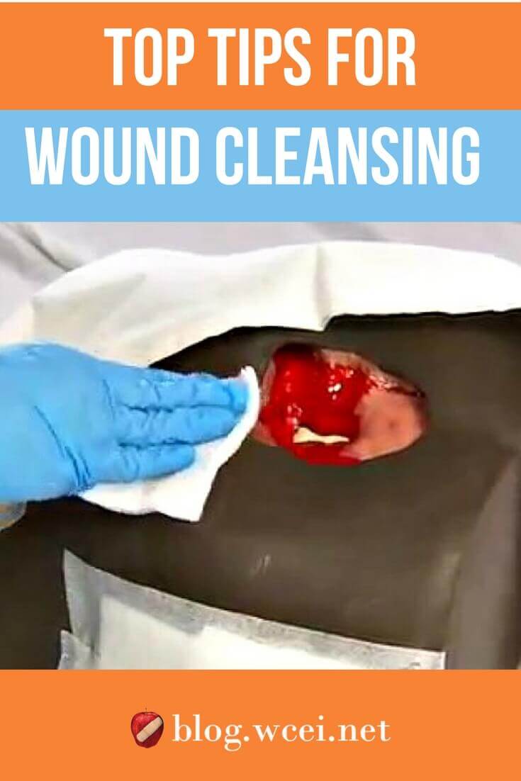 Are your wound-cleansing practices up-to-date? Find out with these top tips for cleaning wounds properly and choosing the right cleansers.