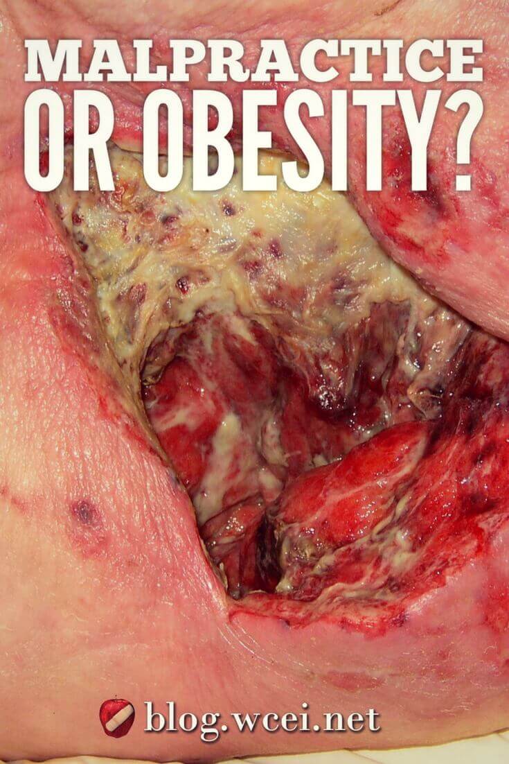 Obesity presents challenges to wound healing, but with knowledge and appropriate care interventions, we can provide optimal conditions to support the best possible outcome for every patient, no matter what size.