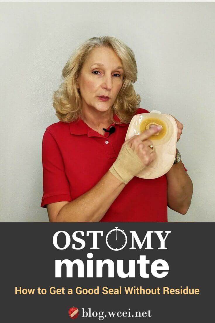 Ostomy Minute: How to Get a Good Seal Without Skin Residue - WCEI Instructor Joy Hooper discusses new products that can create a good seal under the skin barrier of an ostomy appliance without leaving residue.