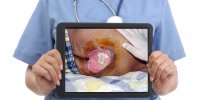 wound care pictures