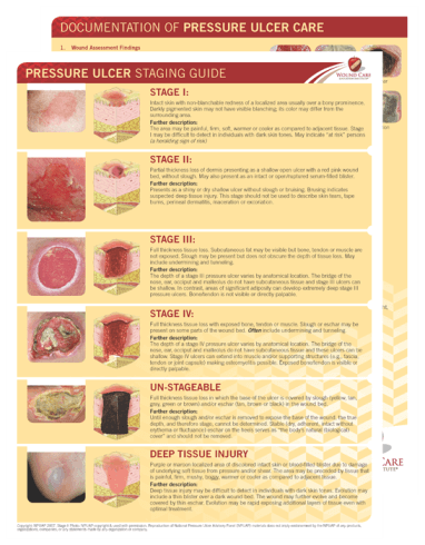 pressure ulcer staging Archives - WCEI - Blog WCEI – Blog