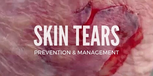 Skin Tears - Prevention and Management