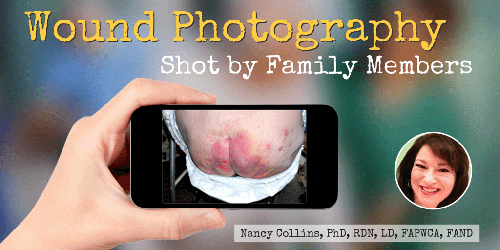 Say Cheese to the Camera: Wound Photography Shot by Family Members