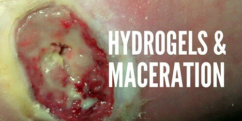 Maceration and Hydrogels? Just Say Whoa