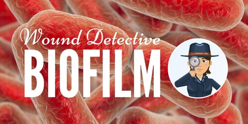 Wound Detective Series: How to Get Away with Killing Biofilm