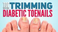 Diabetic Toenails: Top Tips for Proper Trimming | WCEI Blog WCEI Blog