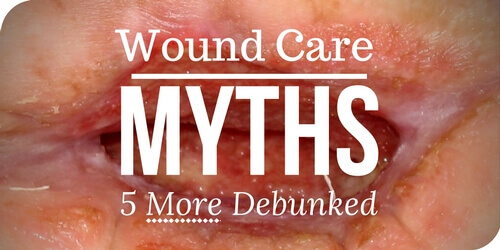 Wound Care Myths: 5 More Debunked