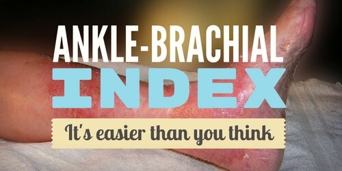 Ankle-Brachial Index? It’s Easier Than You Think