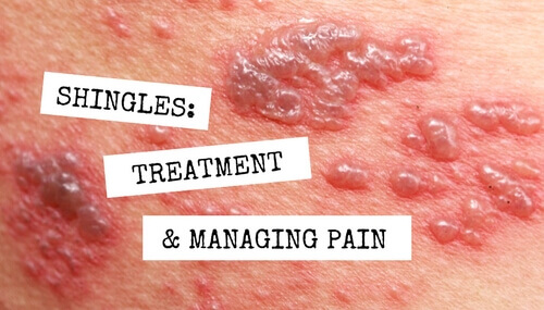 Identifying and Treating Shingles on Your Leg and Groin - Pensler Vein  Institute