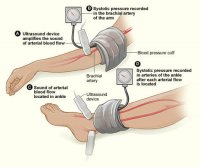 Ankle-Brachial Index? It's Easier Than You Think - WCEI - Blog WCEI – Blog