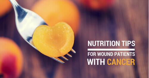 Nutrition Tips for Wound Patients With Cancer