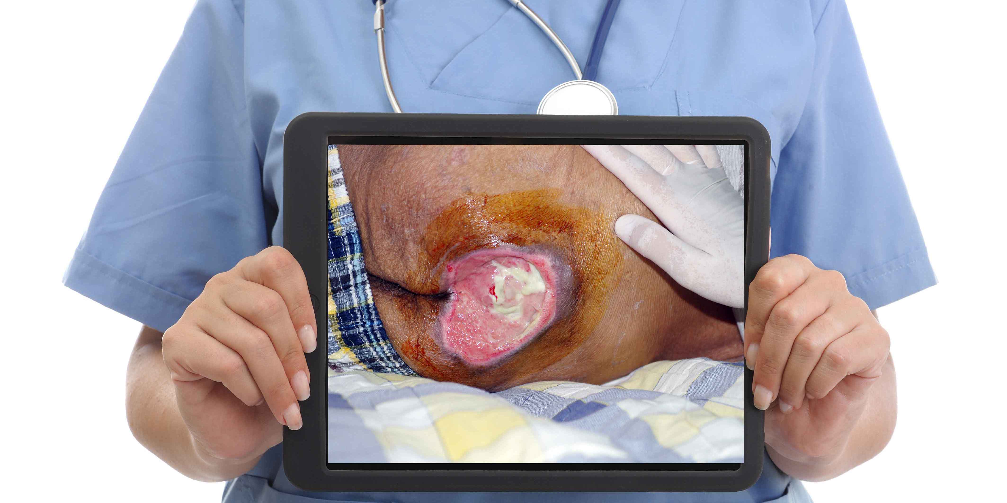 A clinician holds a tablet with a picture of a patient wound on it.