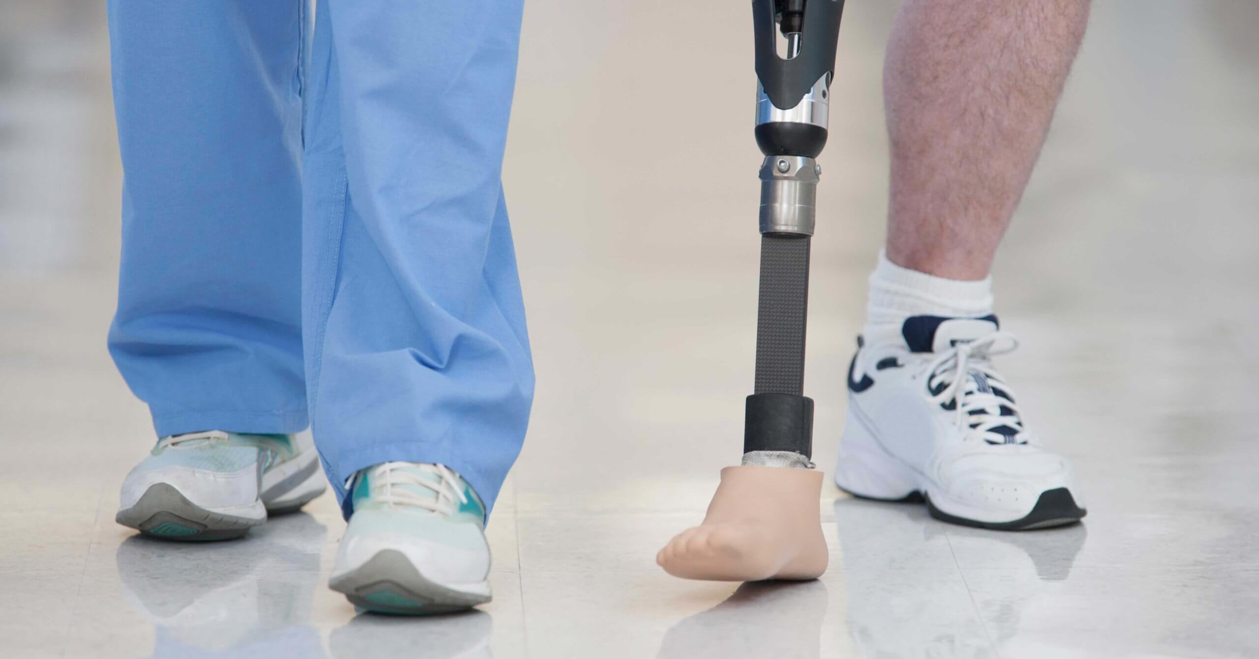 A man with an amputated leg walks in a hallway with a nurse.