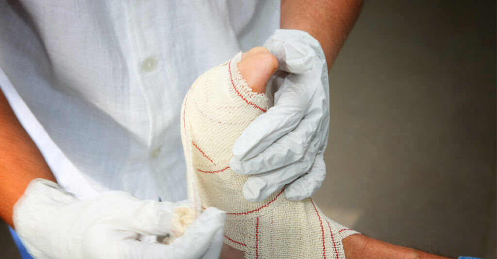 Foot wounds