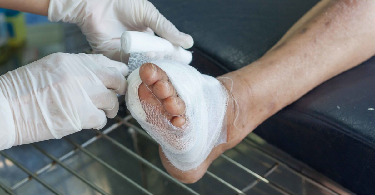 wound dressing on a patient's foot