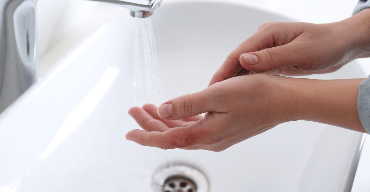 person washes their hands with apparent burn wound in sink