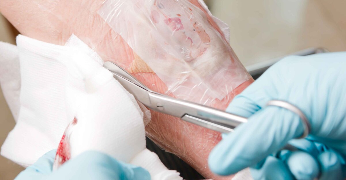 wound dressing being cut with surgical scissors