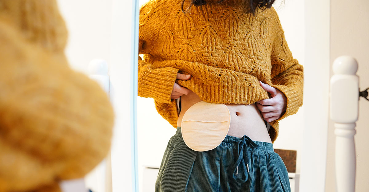 ostomy patient looking in the mirror