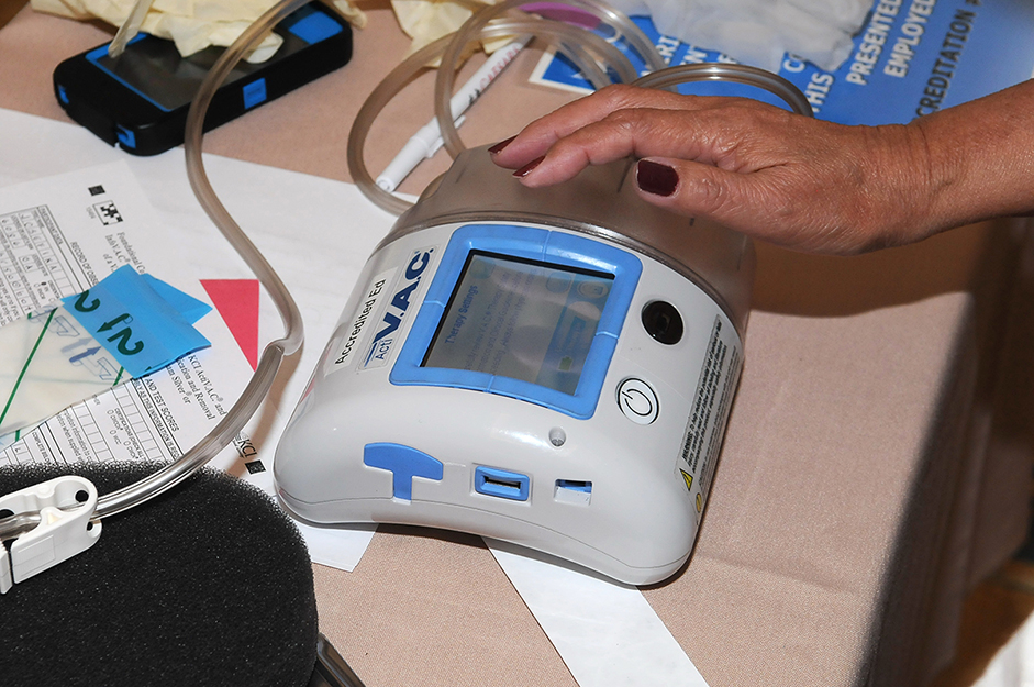 Wound VAC Equipment