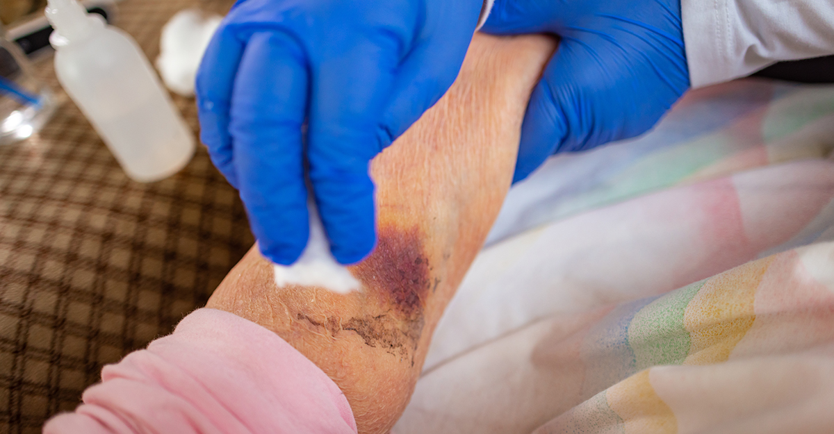 Nurse cleaning a wound