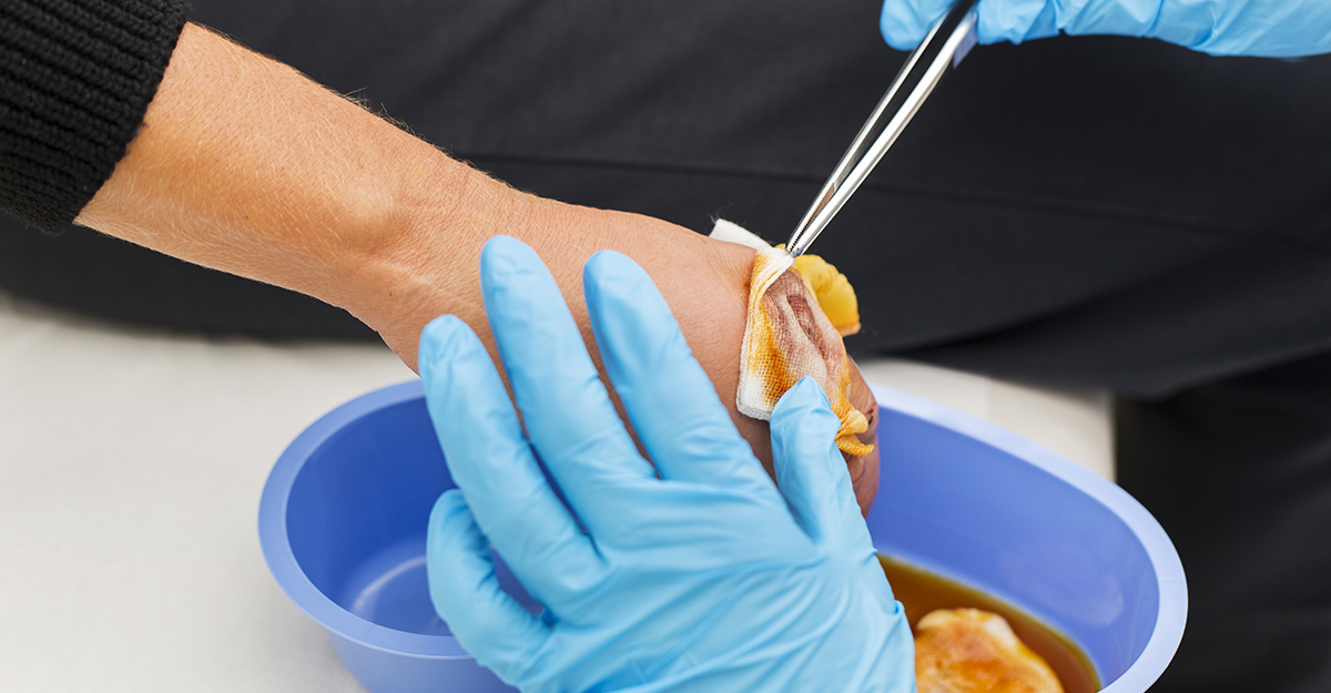 Nurse is taking care of a patient with the wounded wrist, soaking bandage