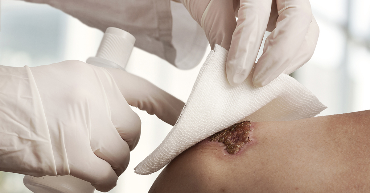 Medical assistant changes the dressing of a wound at the emergency room